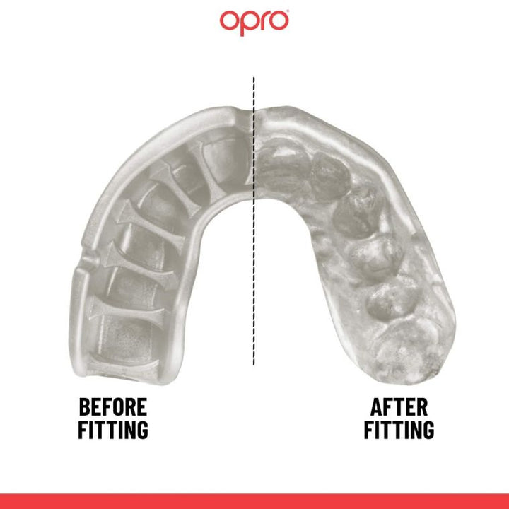 OPRO Gold Ultra Fit Mouthguard Blue/White